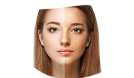 LÀM TRẮNG DA MẶT STEM CELL WHITE SKIN